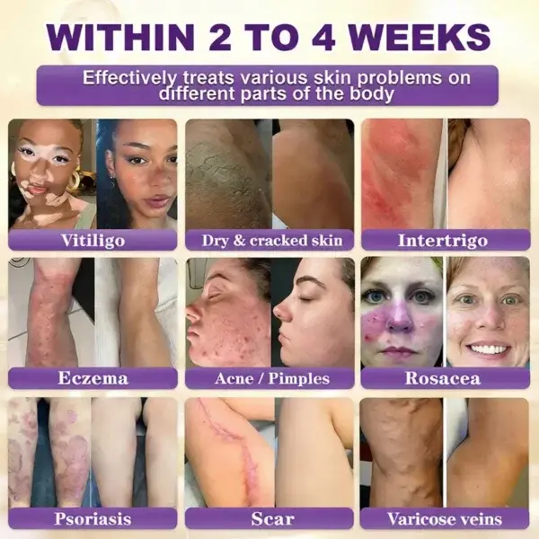 Biotin 10-in-1 Skin Restoration Cream – Last Day Promotion: 75% OFF - Image 11
