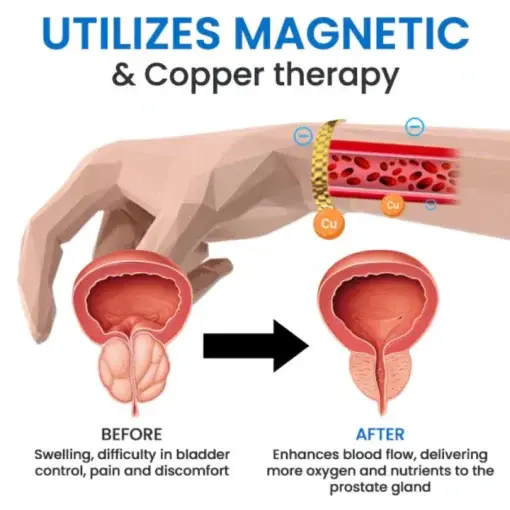 ProstateFlow RF Therapy Band - Image 2