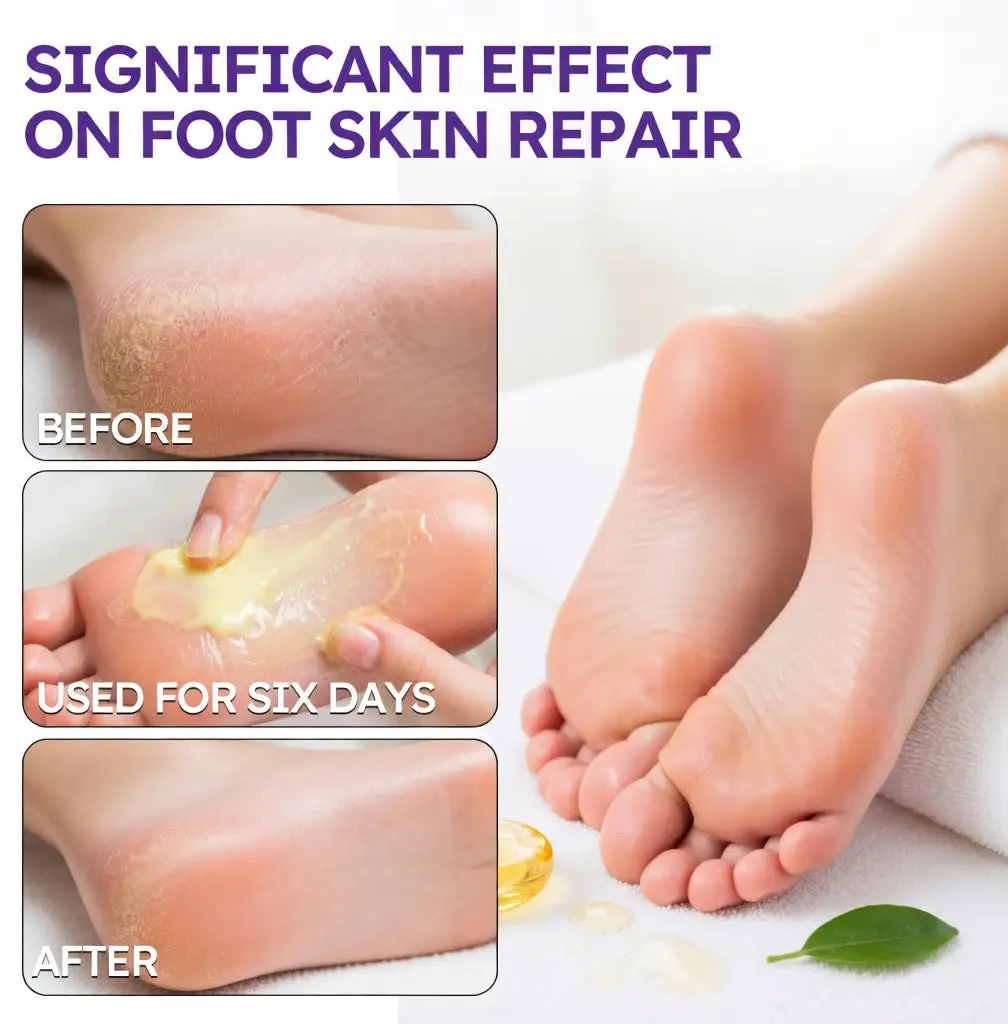 Tea Tree Oil Foot Cream - Image 6