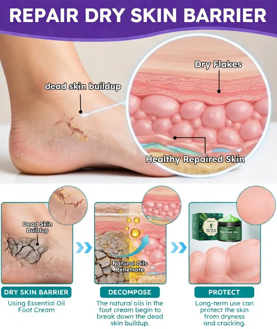 Tea Tree Oil Foot Cream - Image 9