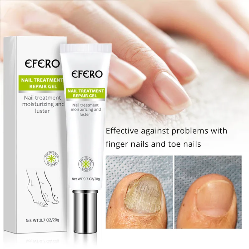 Nail 7 Days Treatment Gel - Image 3