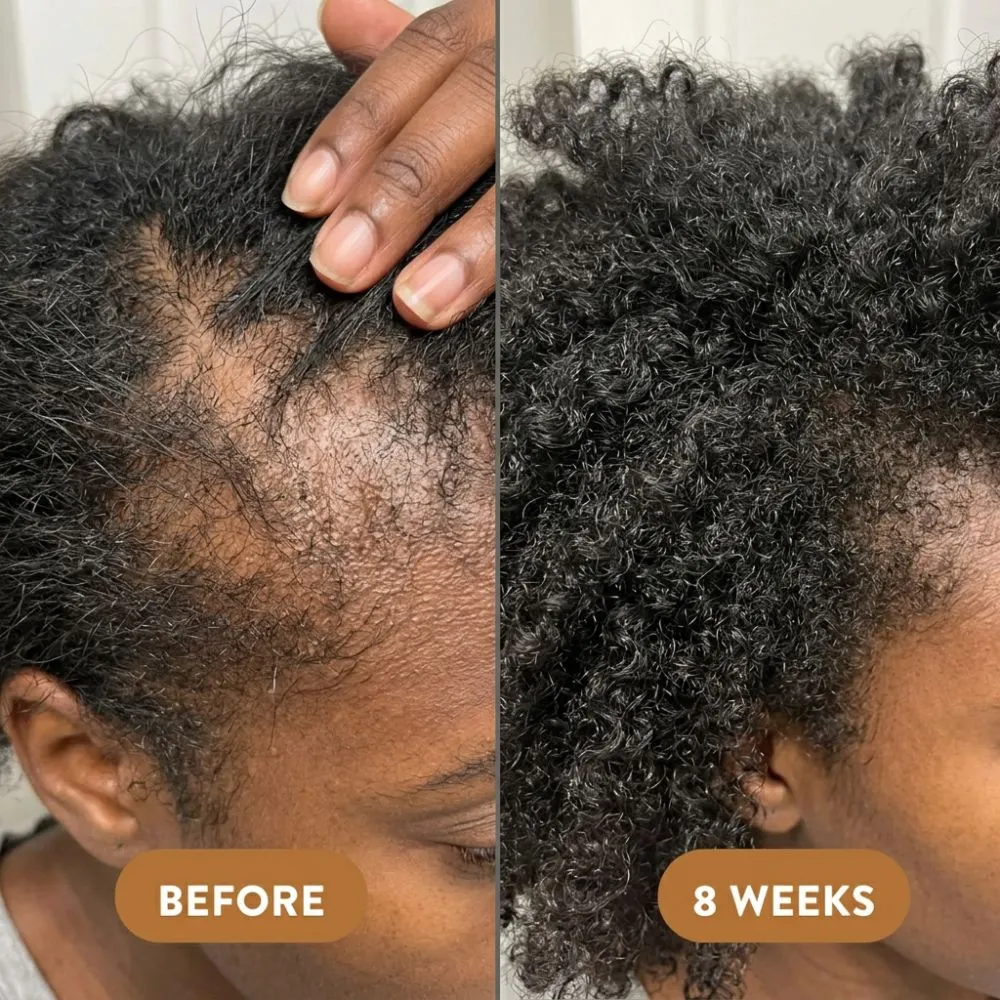 Batana Oil Shampoo 300ml+Batana Oil Conditioner 300ml(1 Set) - Image 10