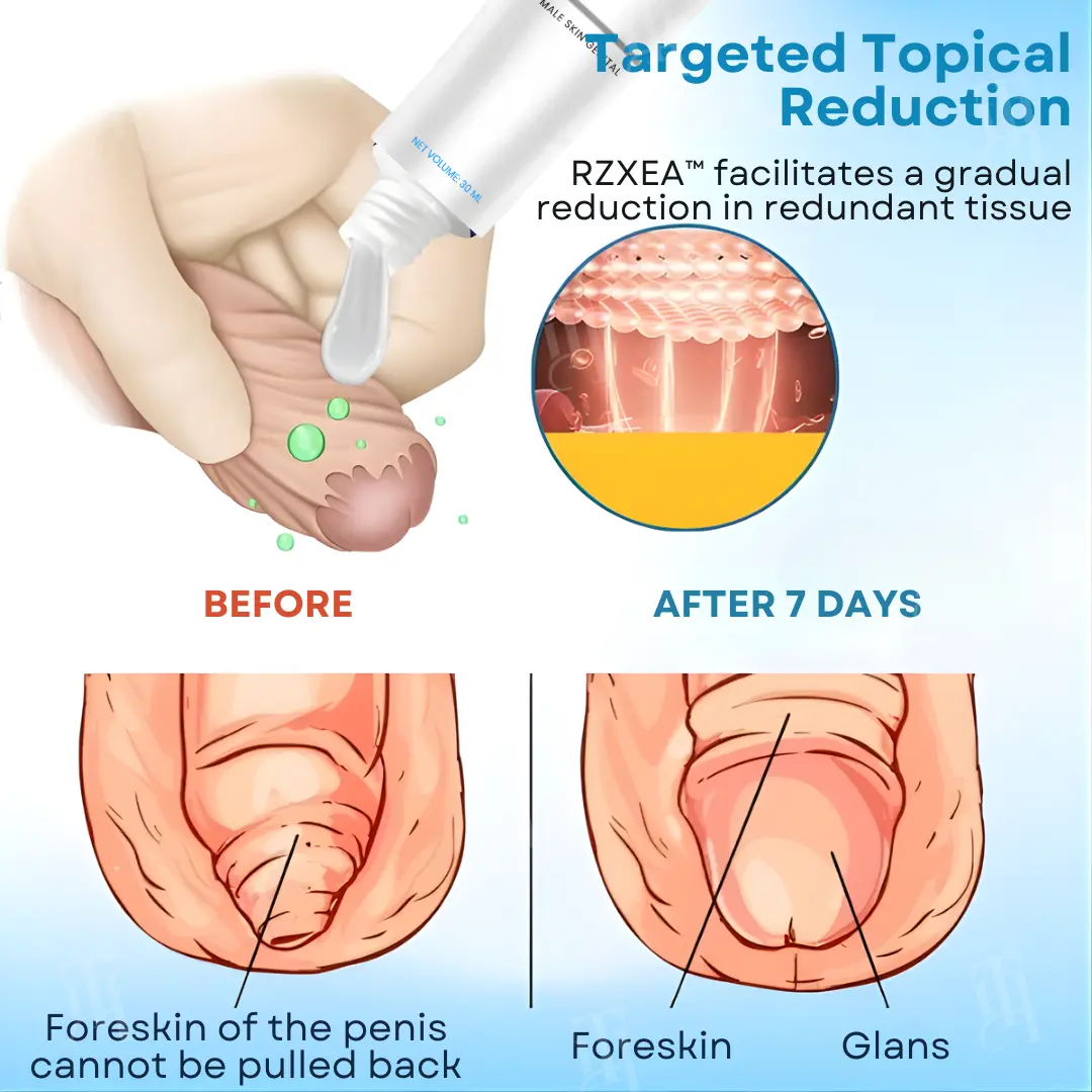 7-Day Redundant Prepuce Corrective Gel - Image 4