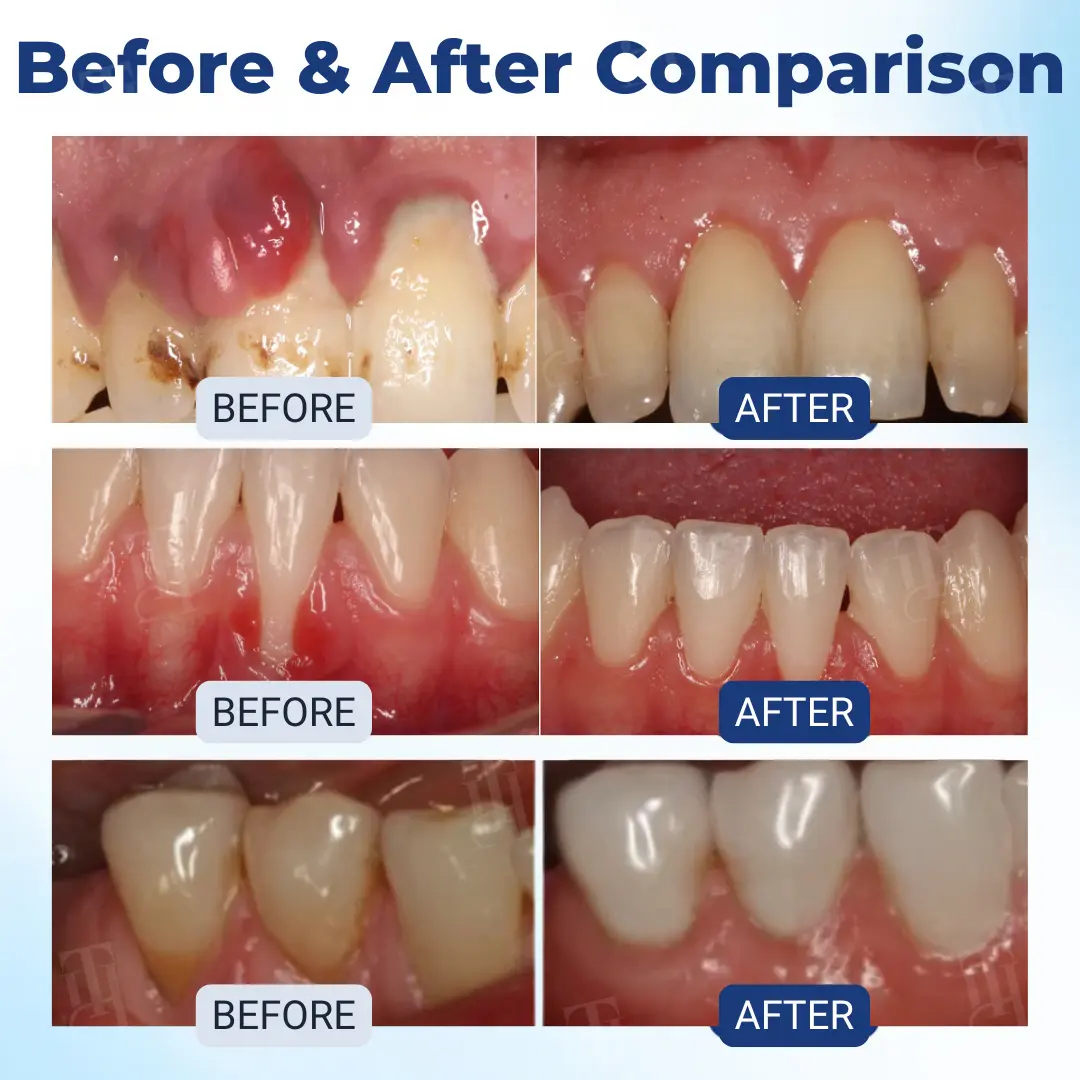 Postbiotics Bee Gumcare Solution - Image 2