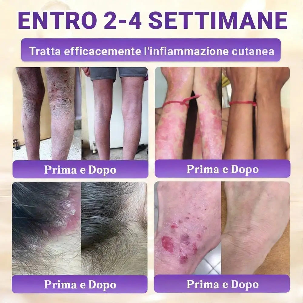 Biotin 10-in-1 Skin Restoration Cream - Image 6