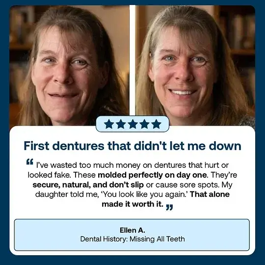 Custom-Fit Full Functional DenturesMake you more confident-Made in the USA - Image 5