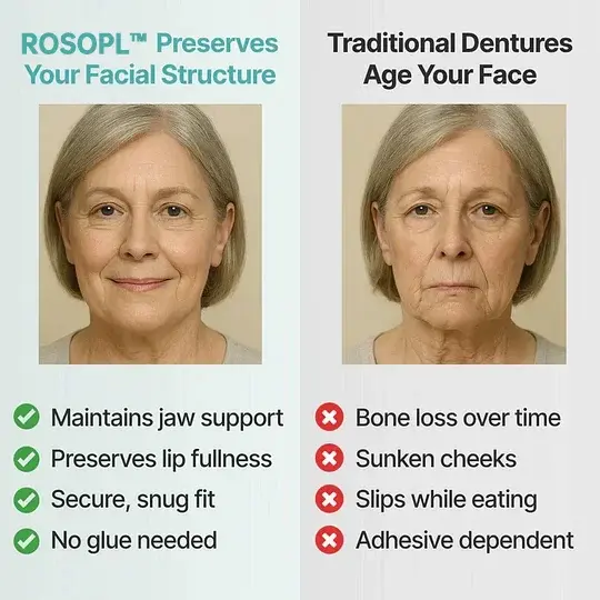 Custom-Fit Full Functional DenturesMake you more confident-Made in the USA - Image 8