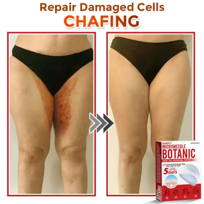 MicroNeedle Skin Growth Removal Patch - Image 3