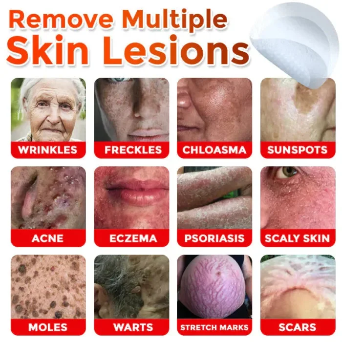 MicroNeedle Skin Growth Removal Patch - Image 2