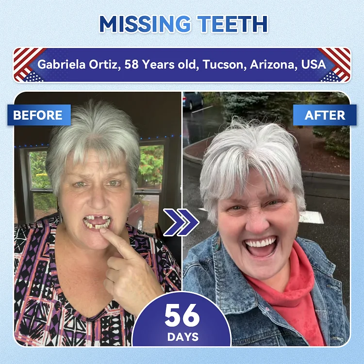 Tideglusib Fast‑Dissolving Tooth & Gum Repair Oral Strips - Image 4