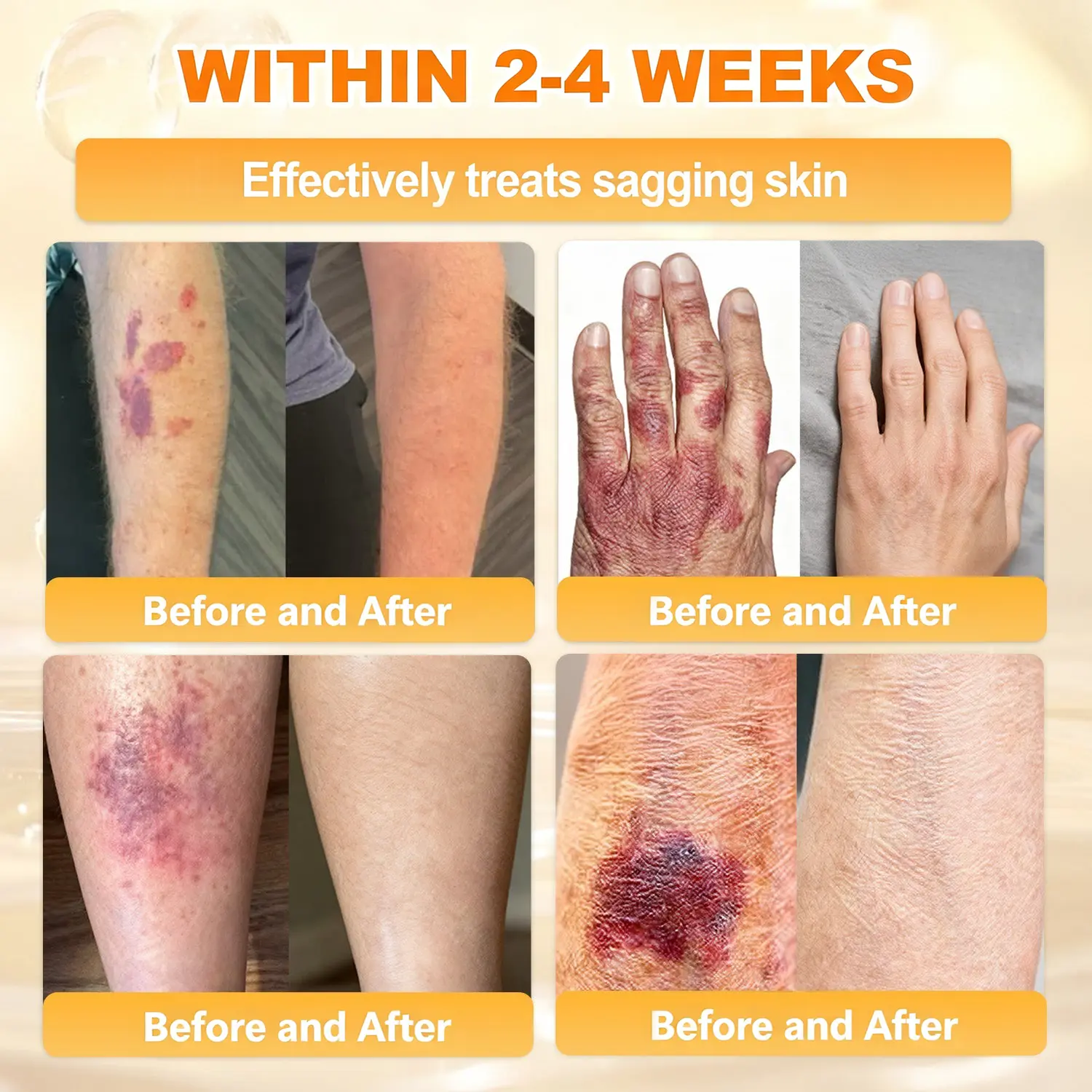 Bee Poison Skin Renewal Cream - Image 5