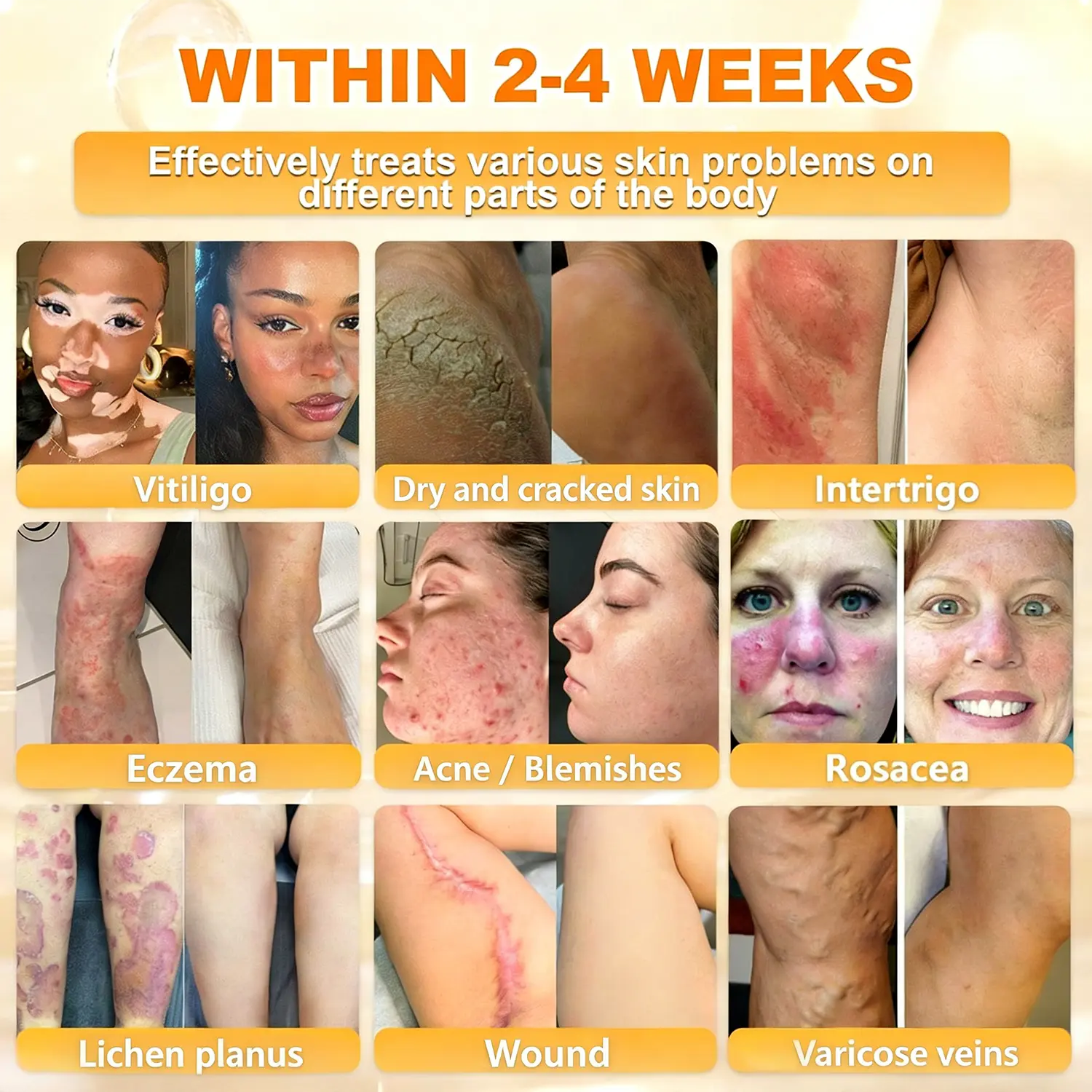 Bee Poison Skin Renewal Cream - Image 7