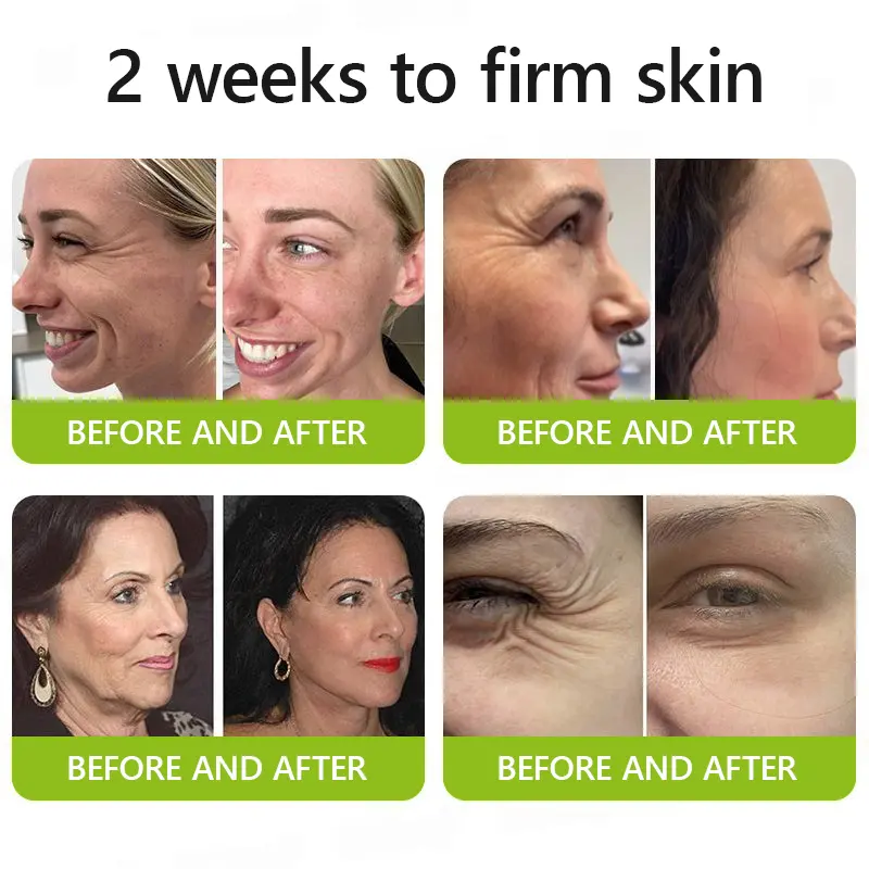 BOTOX & VITA A RETINOL SHOT Wrinkle Lift Tightening Cream - Image 3
