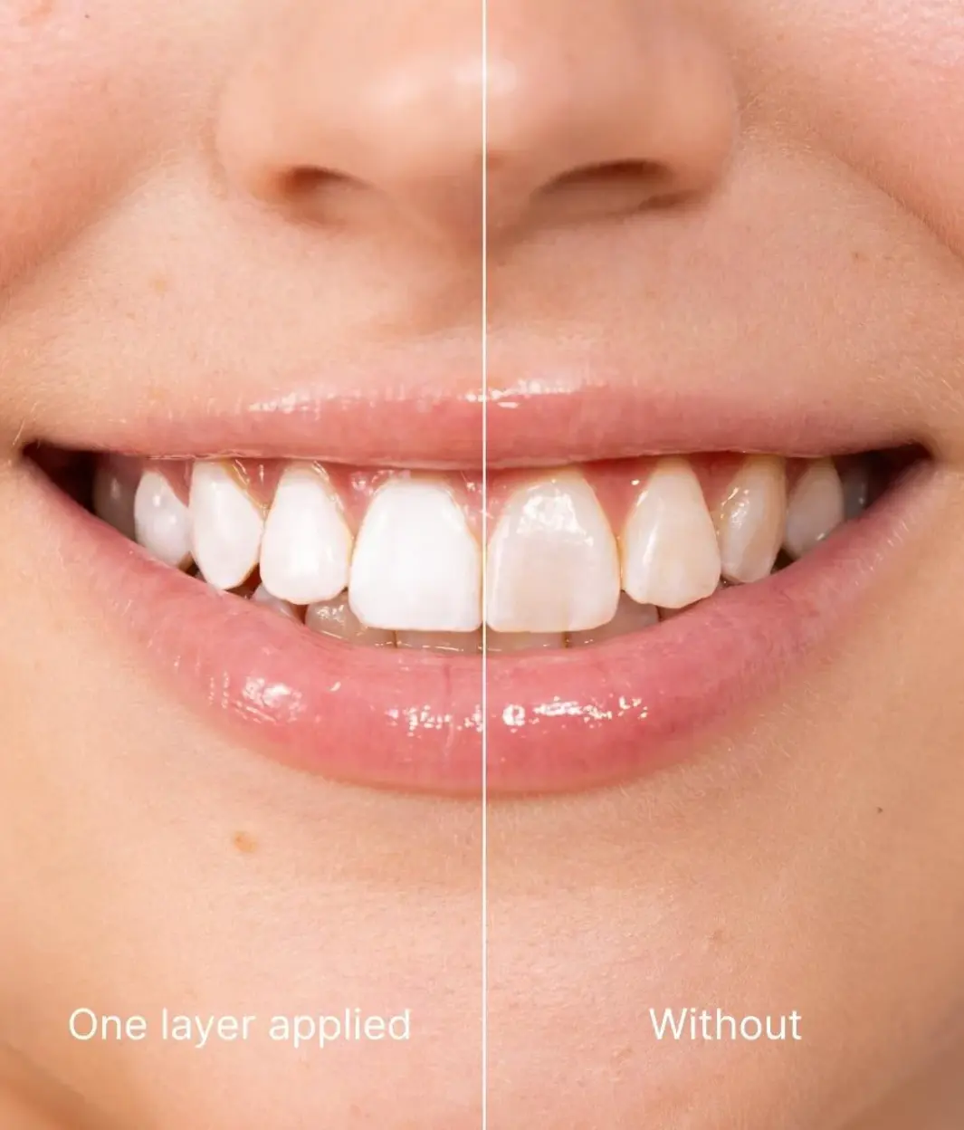Skavix Instant White Smile Tooth Polish – Fast Stain Removal & Gentle Enamel Care - Image 4