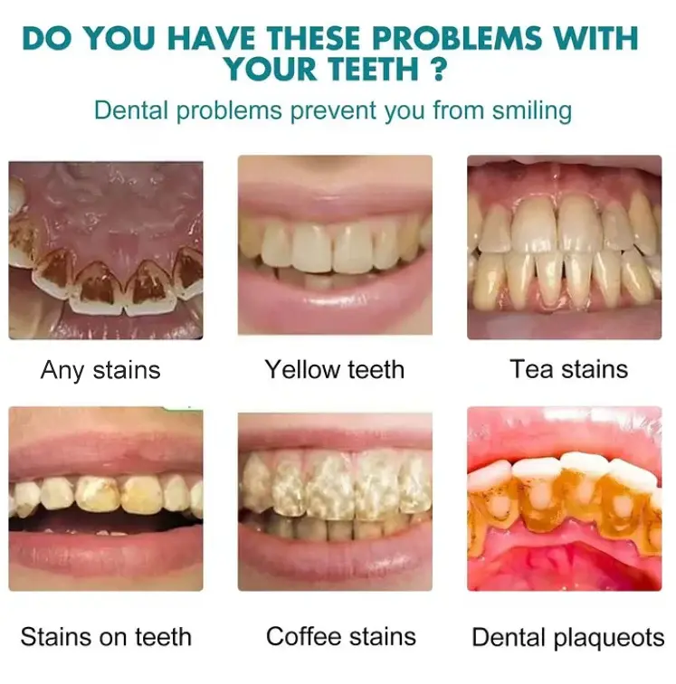 Skavix Instant White Smile Tooth Polish – Fast Stain Removal & Gentle Enamel Care - Image 6
