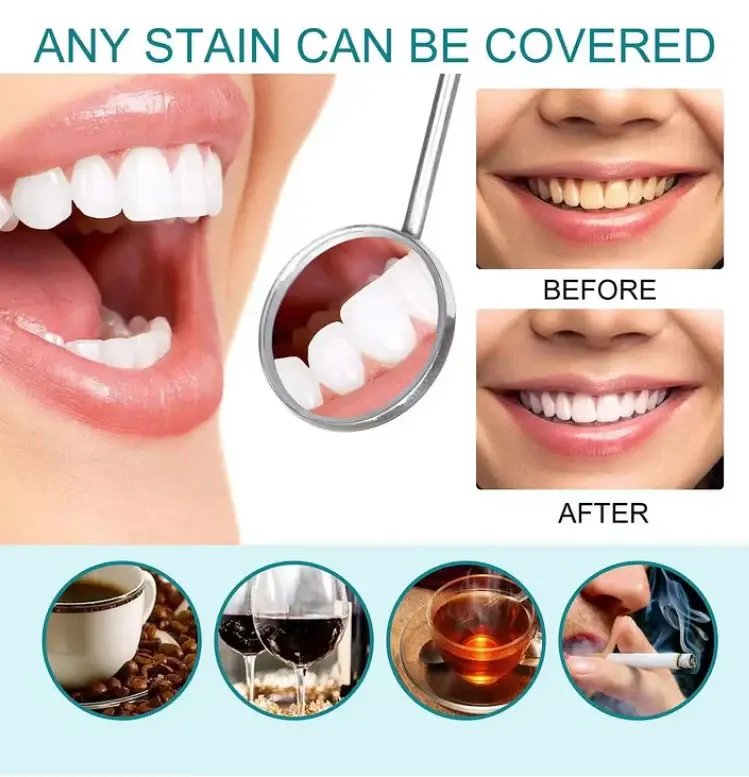 Skavix Instant White Smile Tooth Polish – Fast Stain Removal & Gentle Enamel Care - Image 7