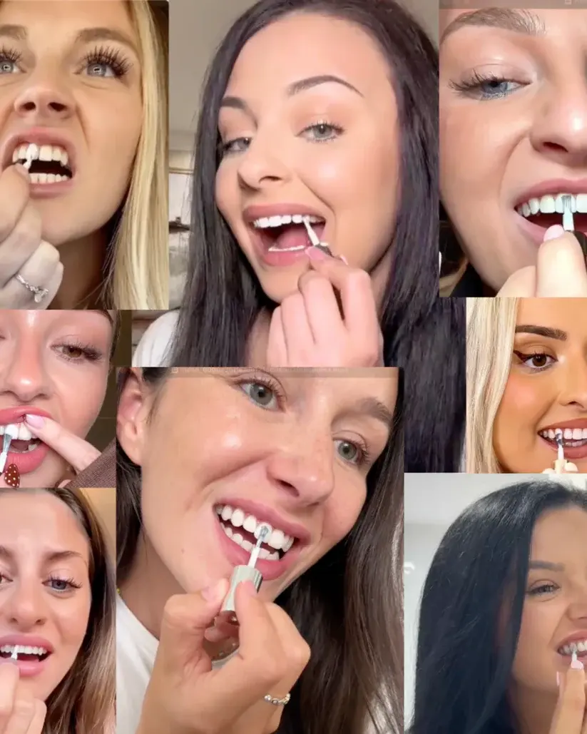 Skavix Instant White Smile Tooth Polish – Fast Stain Removal & Gentle Enamel Care - Image 8
