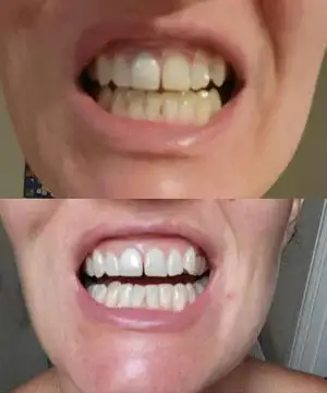 Stain Whitening Mouthwash - Image 7