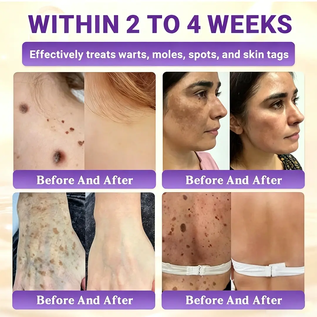 BioColla DermaRenew Cream - Image 5