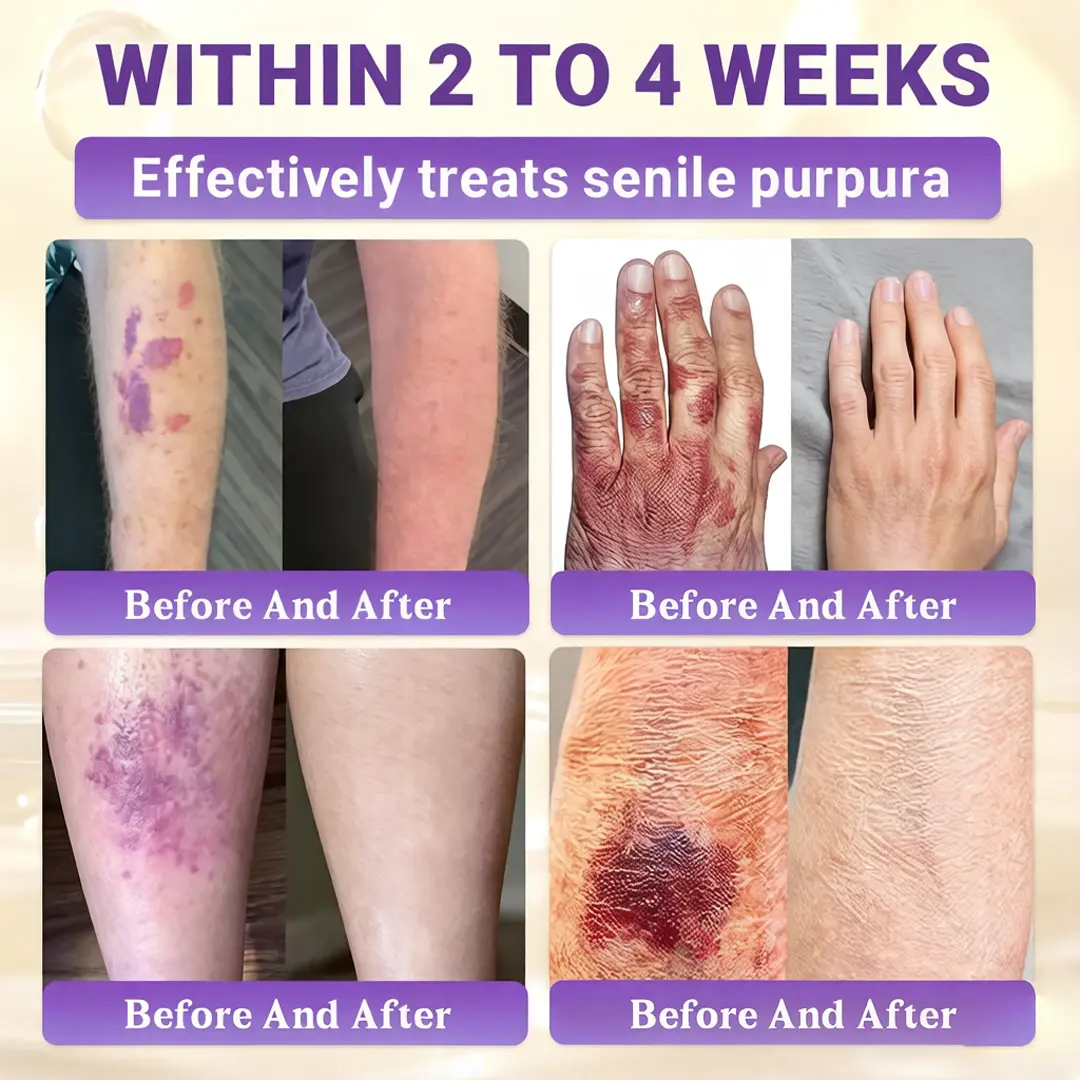 Biotin 10-in-1 Skin Restoration Cream - Image 7