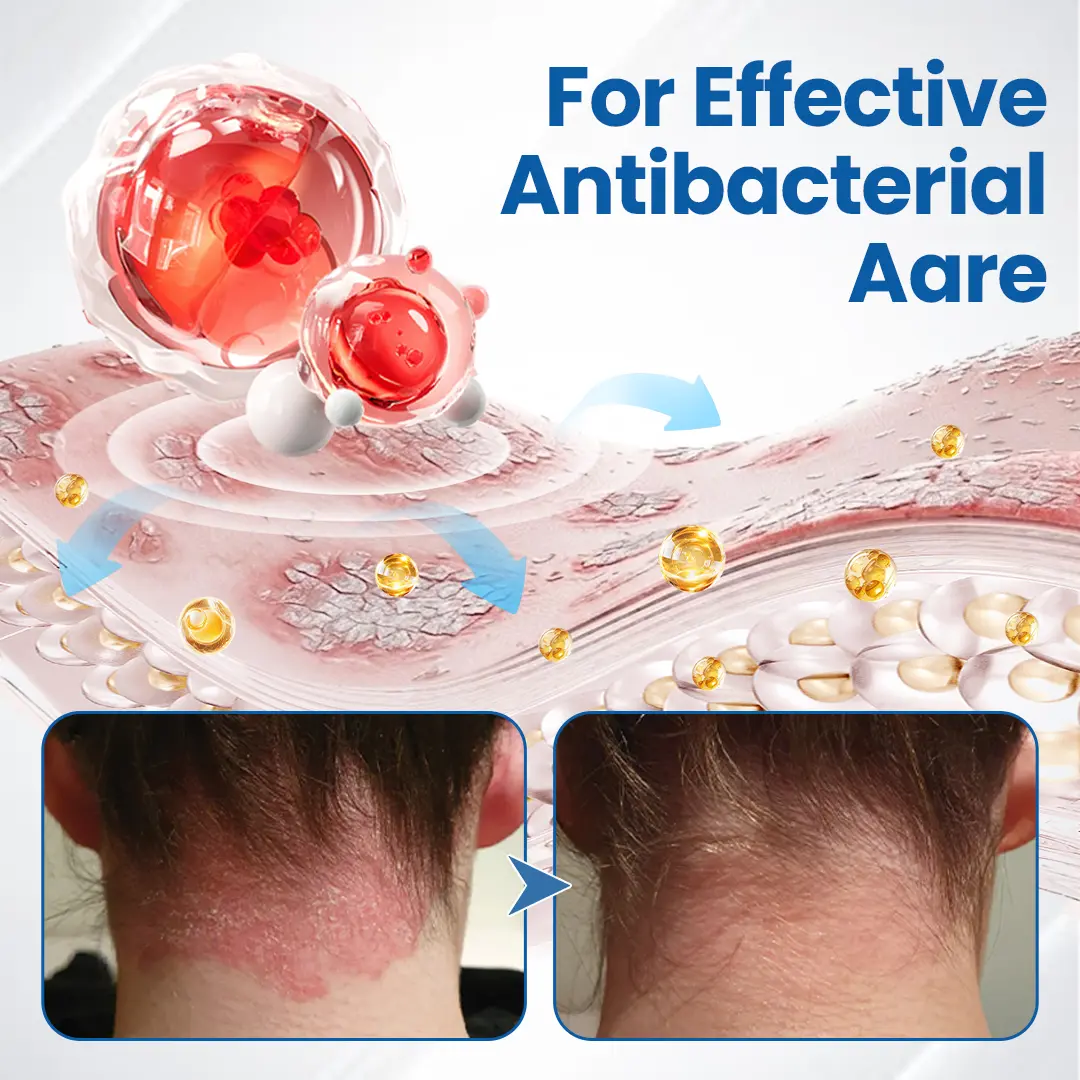 Fragile Skin Repair Cream - Image 12