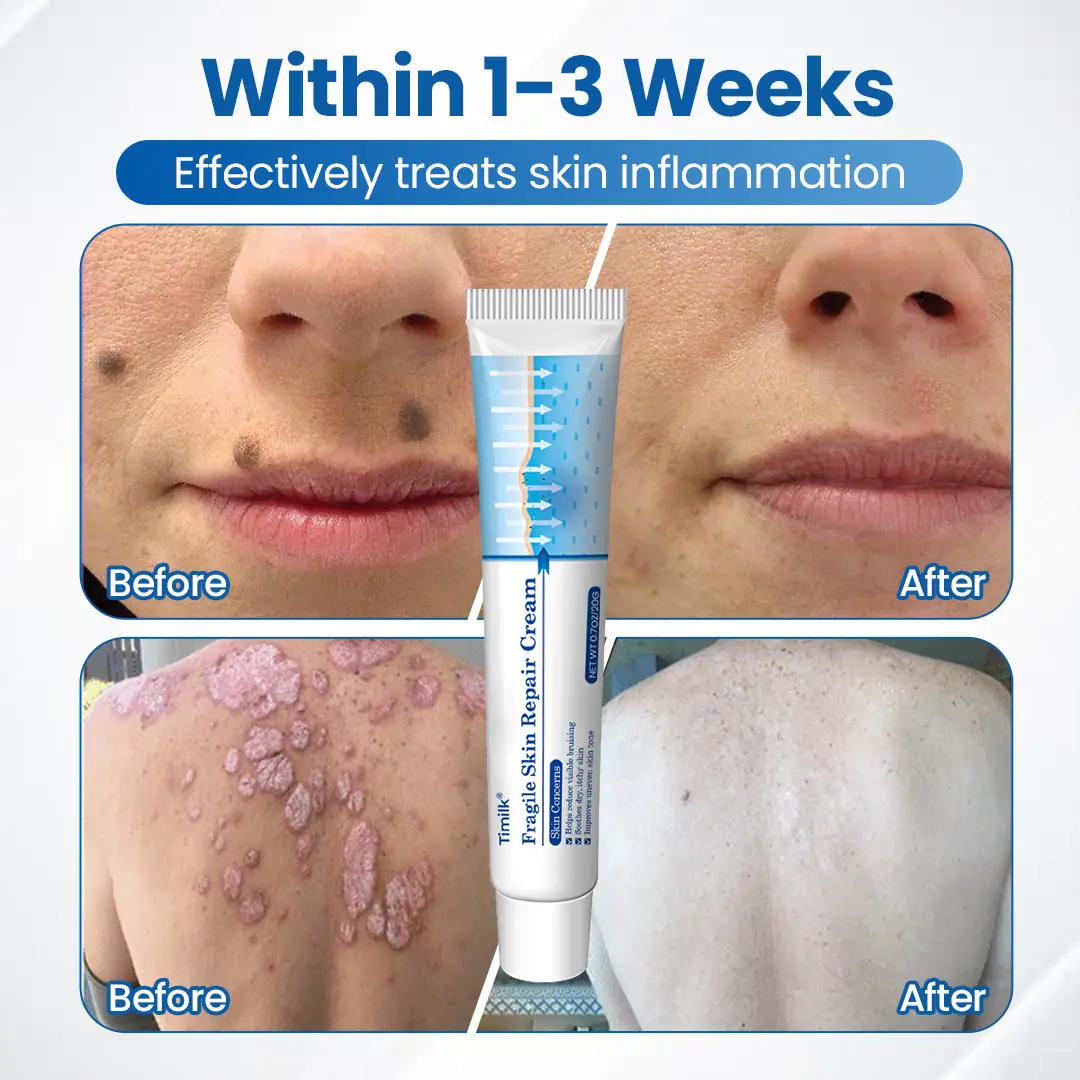 Fragile Skin Repair Cream - Image 3