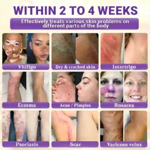 Alternative view of 10-in-1 Skin Clear