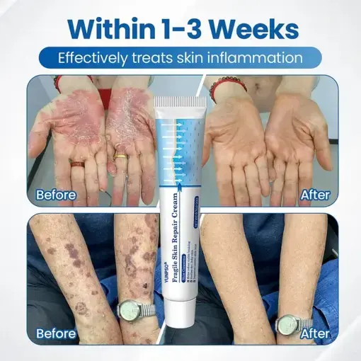 Fragile Skin Repair Cream - Image 2