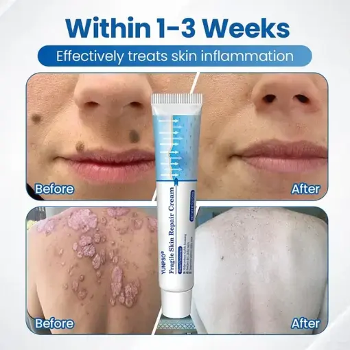 Fragile Skin Repair Cream - Image 3
