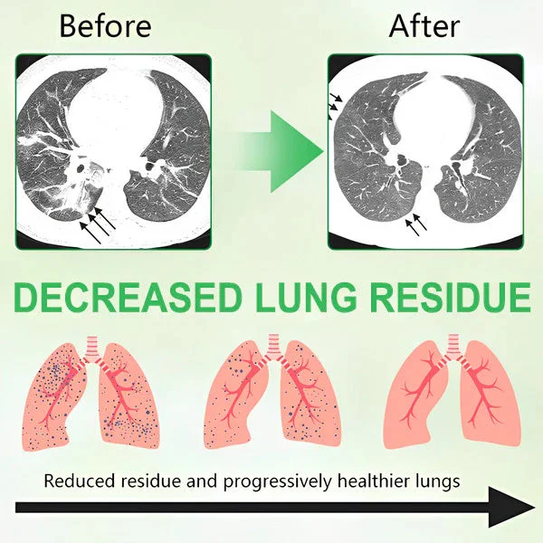 3X Concentrated Mullein Lung Cleanse Spray - Image 5