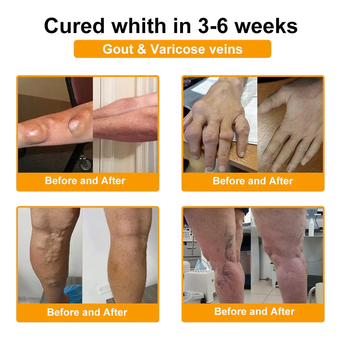 Botulinum Toxin & Bee Venom Pain-Relief Bone Healing Cream - Image 19