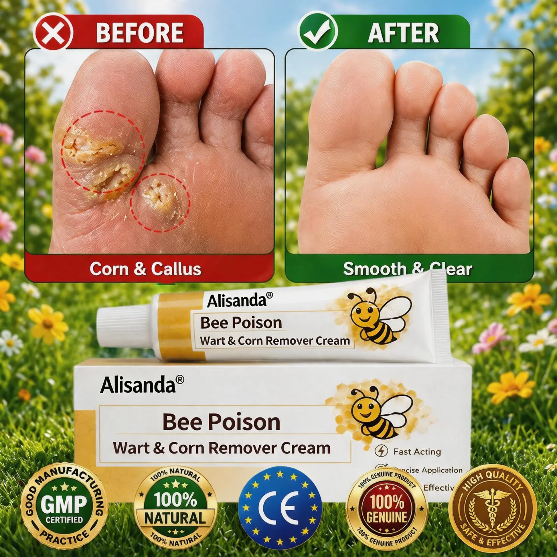 Bee Poison Wart & Corn Remover Cream - Image 3