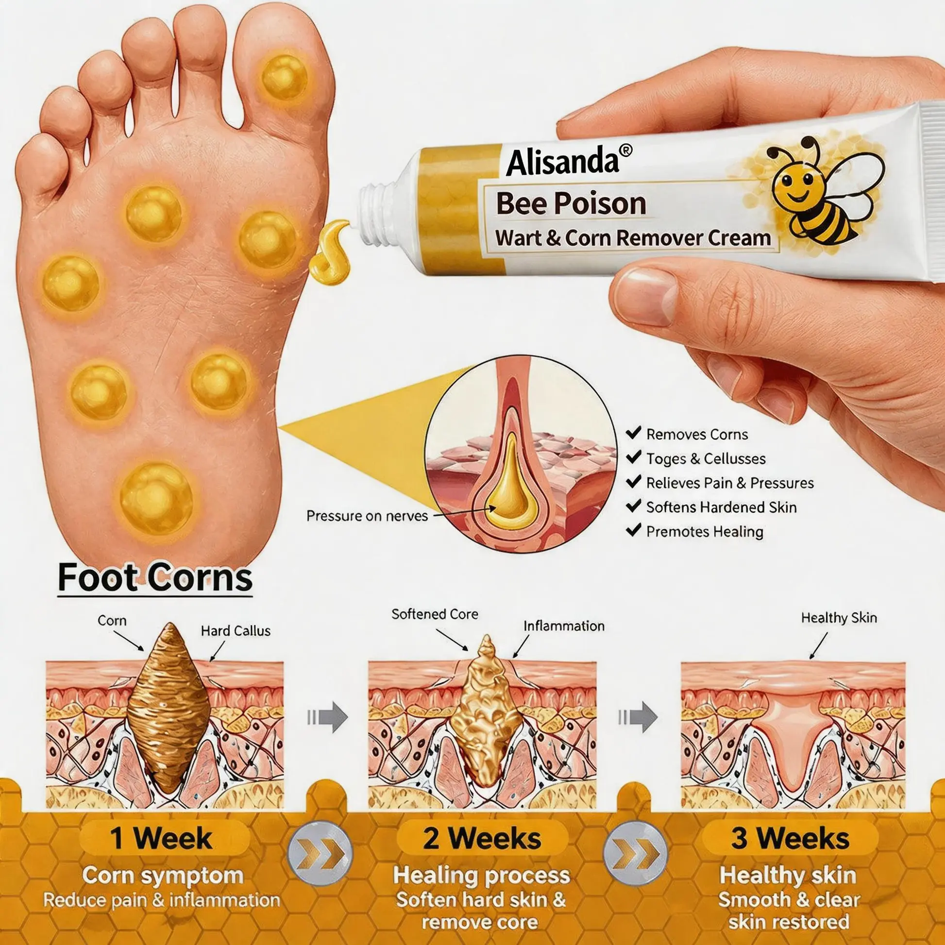 Bee Poison Wart & Corn Remover Cream - Image 5