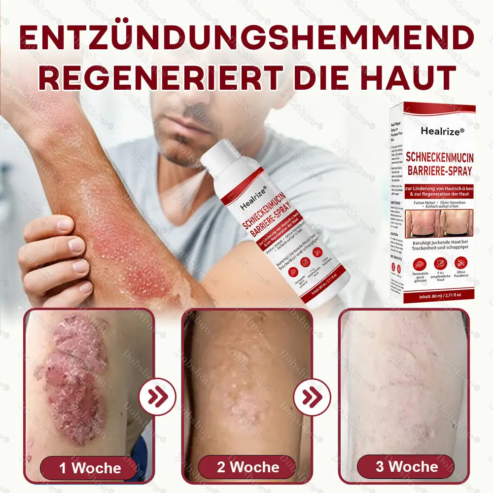 Schneckenmucin-Barriere-Spray zur Linderung von Hautschรผben und zur Regeneration der Haut-๐ฟ๐๐ช๐ฉ๐จ๐๐๐ก๐๐ฃ๐๐จ ๐๐ง. 1 ๐จ๐ฅ๐งรผ๐๐๐๐ง๐ ๐ฝ๐๐ง๐ง๐๐๐ง๐-๐๐๐ก๐๐๐ ๐๐๐ ๐๐จ๐ค๐ง๐๐๐จ๐๐จ - Image 6