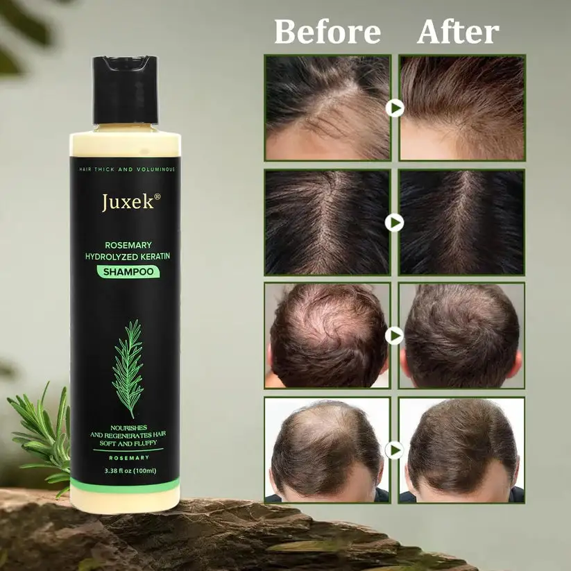 Organic Rosemary Hair Growth Shampoo - Image 2