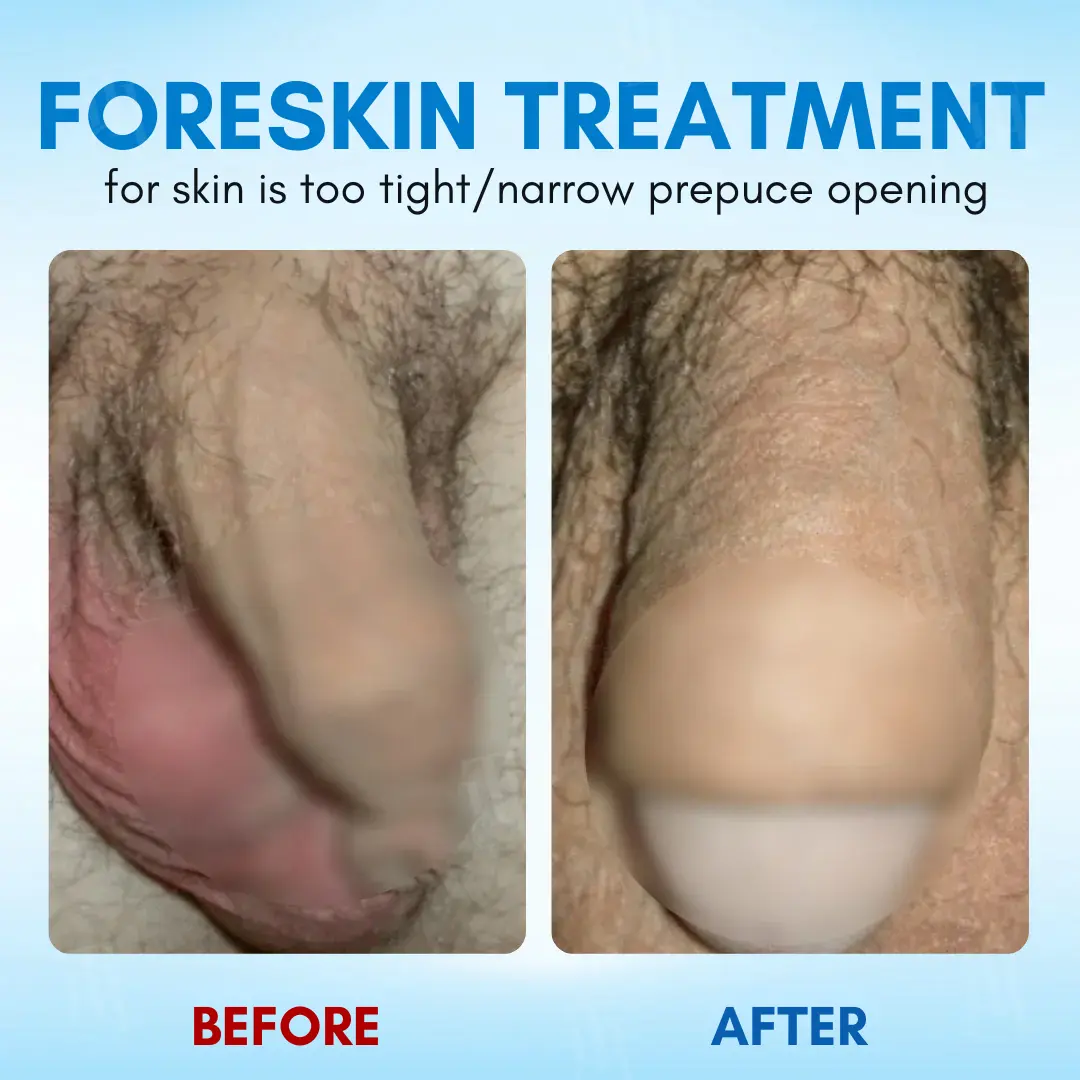 Nano-Apitoxin Men's Performance Gel | - Image 2