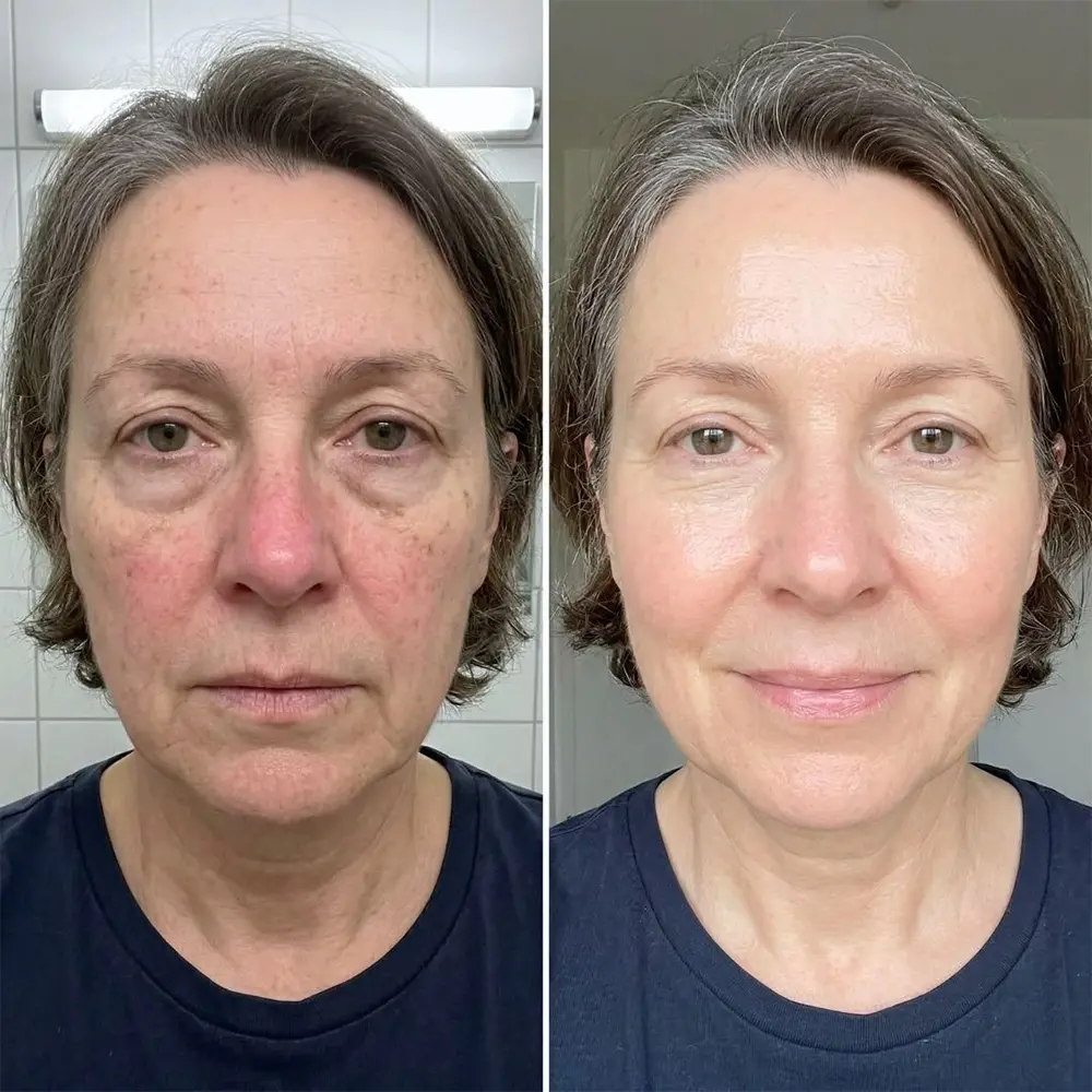 AdaptaShade Foundation - Image 6