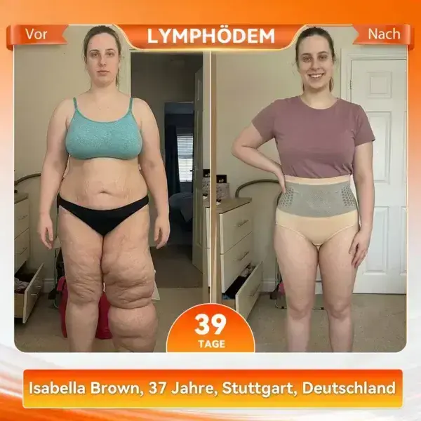 2026: Intelligente Moringa &Berberin Shaping-Shorts für effektive Fettverbrennung - Image 2