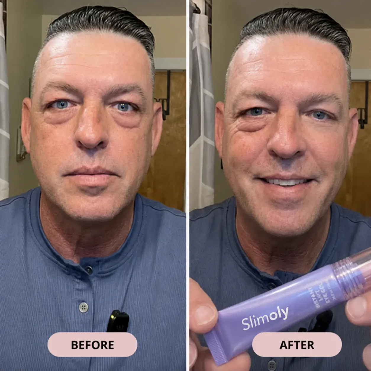 Instant Eye Tightening Gel - Image 11
