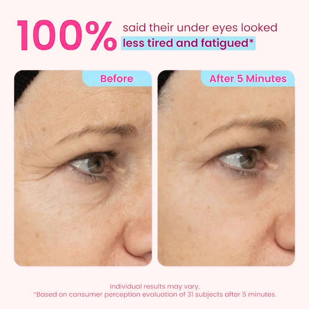 Instant Eye Tightening Gel - Image 5