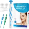 14Pcs Left🔥 | Auto-Micro Skin Tag Remover Kit