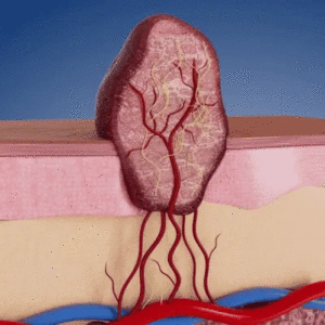 Alternative view of 2-in-1 Microneedle & Hydrocolloid Patch