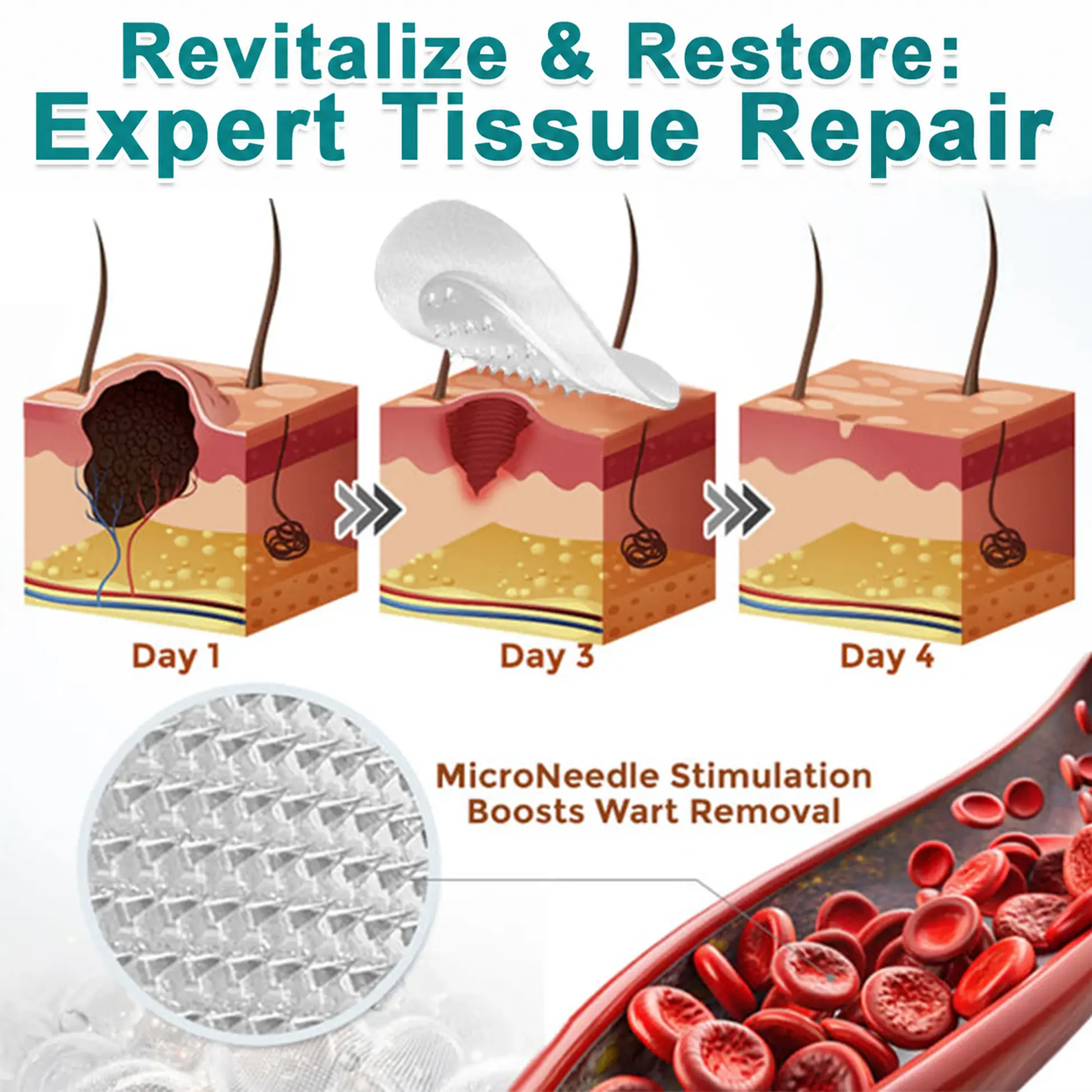 2-in-1 Microneedle & Hydrocolloid Patch - Image 8