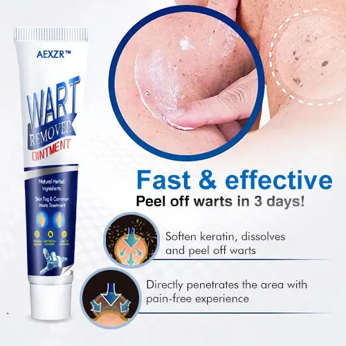 Wart Removal Ointment - Image 3