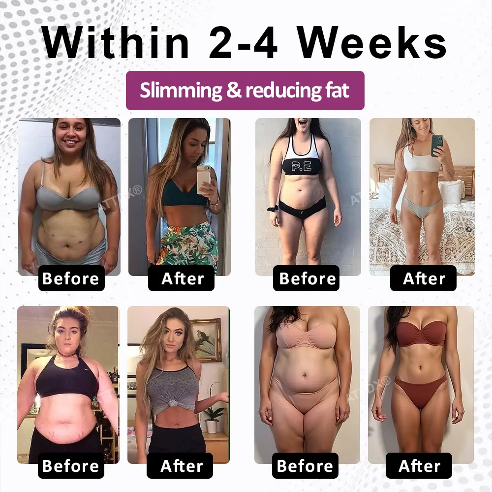 FemmeShape GutSlim Probiotics - Image 2