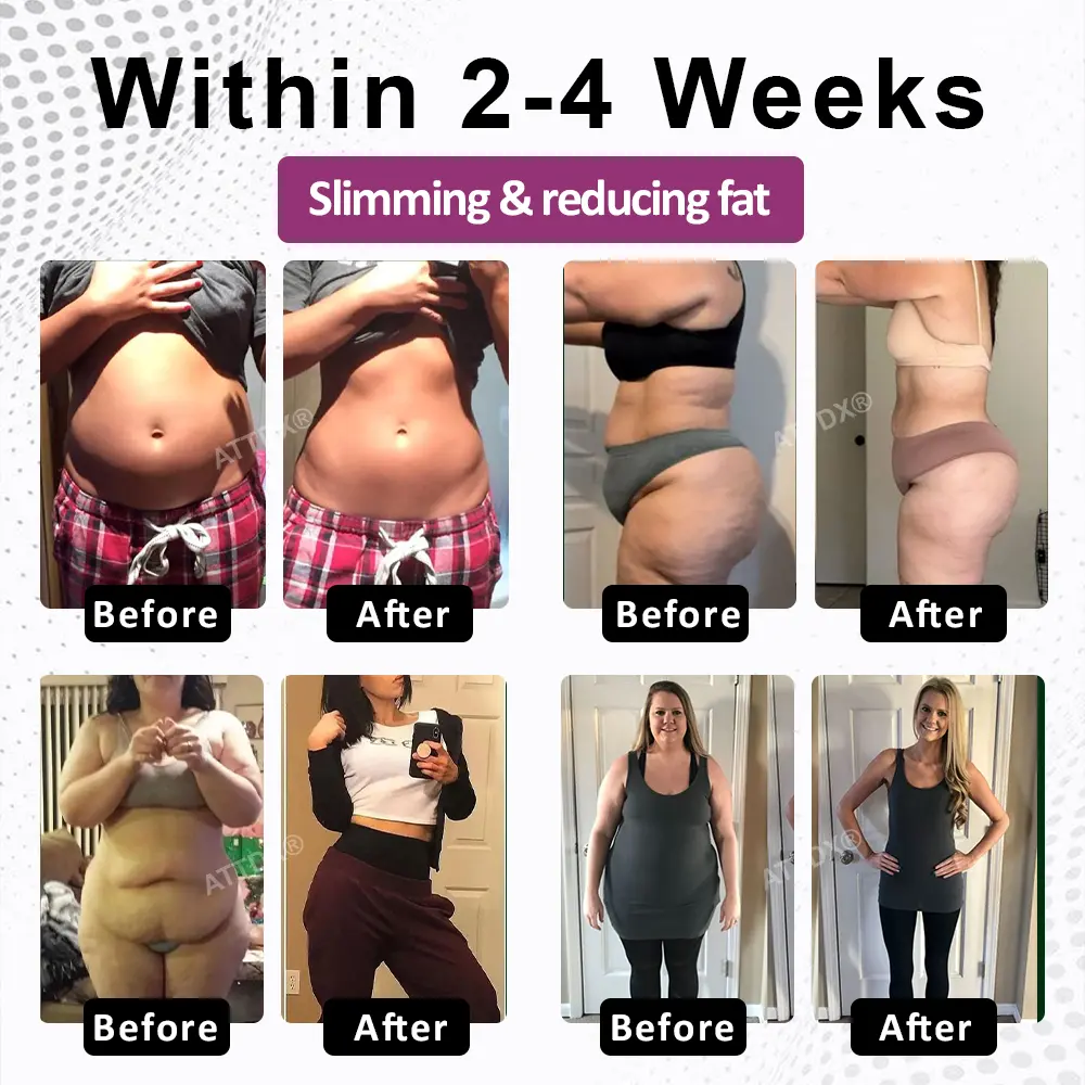 FemmeShape GutSlim Probiotics - Image 3