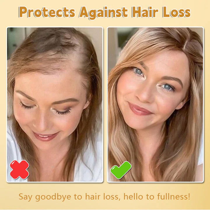 Biotin Hair Growth Essence Spray - Image 2