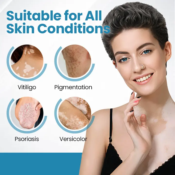 DermaBeam Vitiligo Therapy Device - Image 9