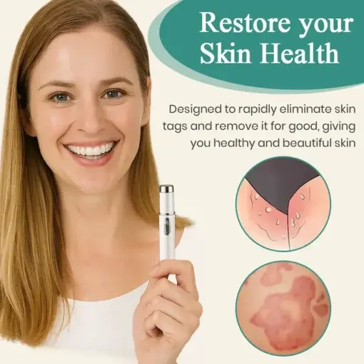 HPV Genital Warts Removal Laser Pen - Image 7