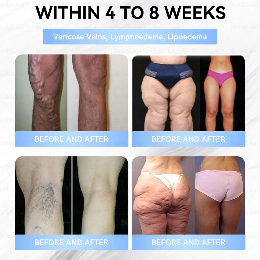 Slim & Firm Nano Microneedle Patch with Collagen - Image 7